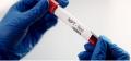 novel-prenatal-testing's picture novel-prenatal-testing's picture